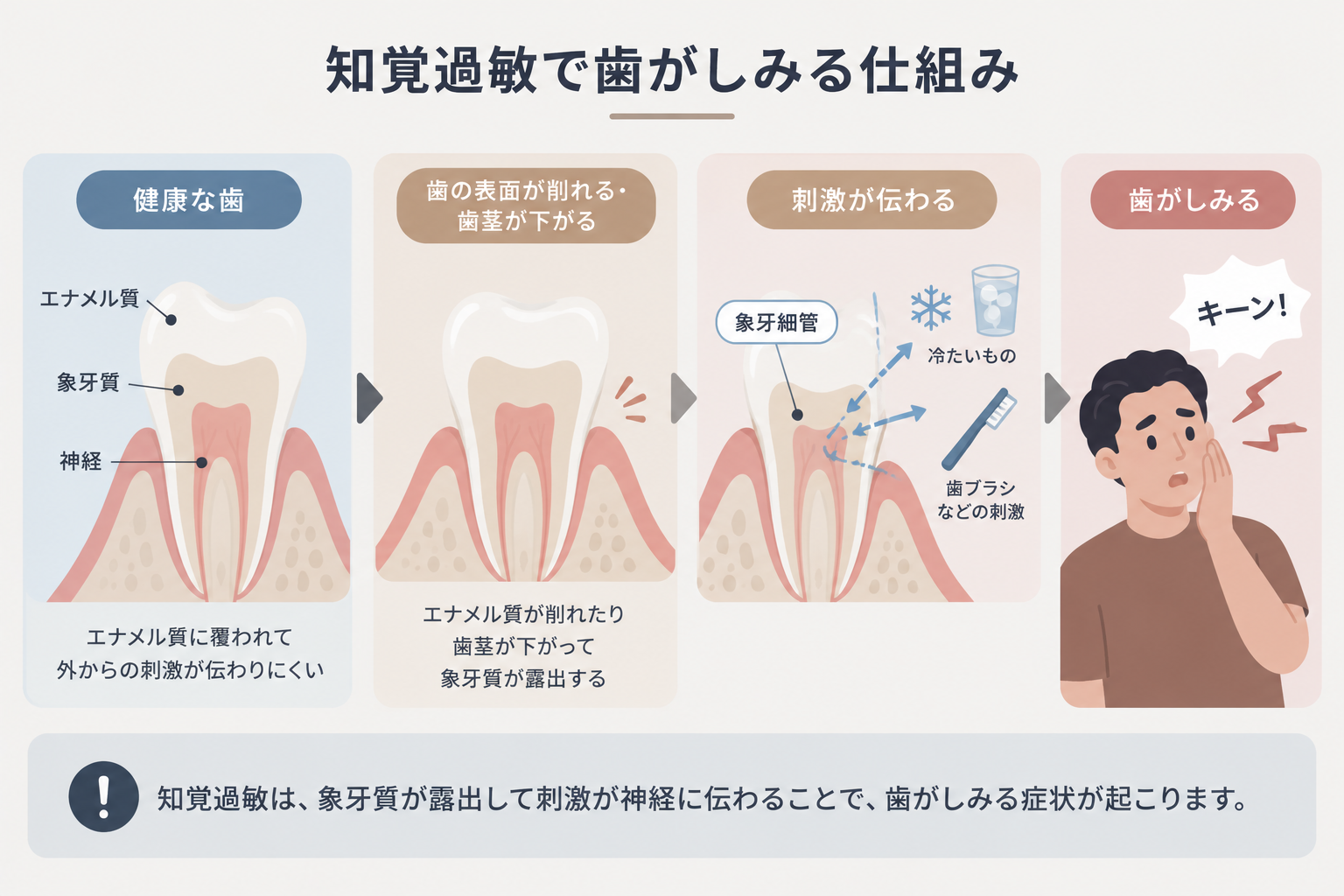 象牙質が露出して知覚過敏で歯がしみる仕組みを示した図