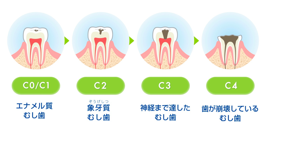 オールセラミック前歯部症例3