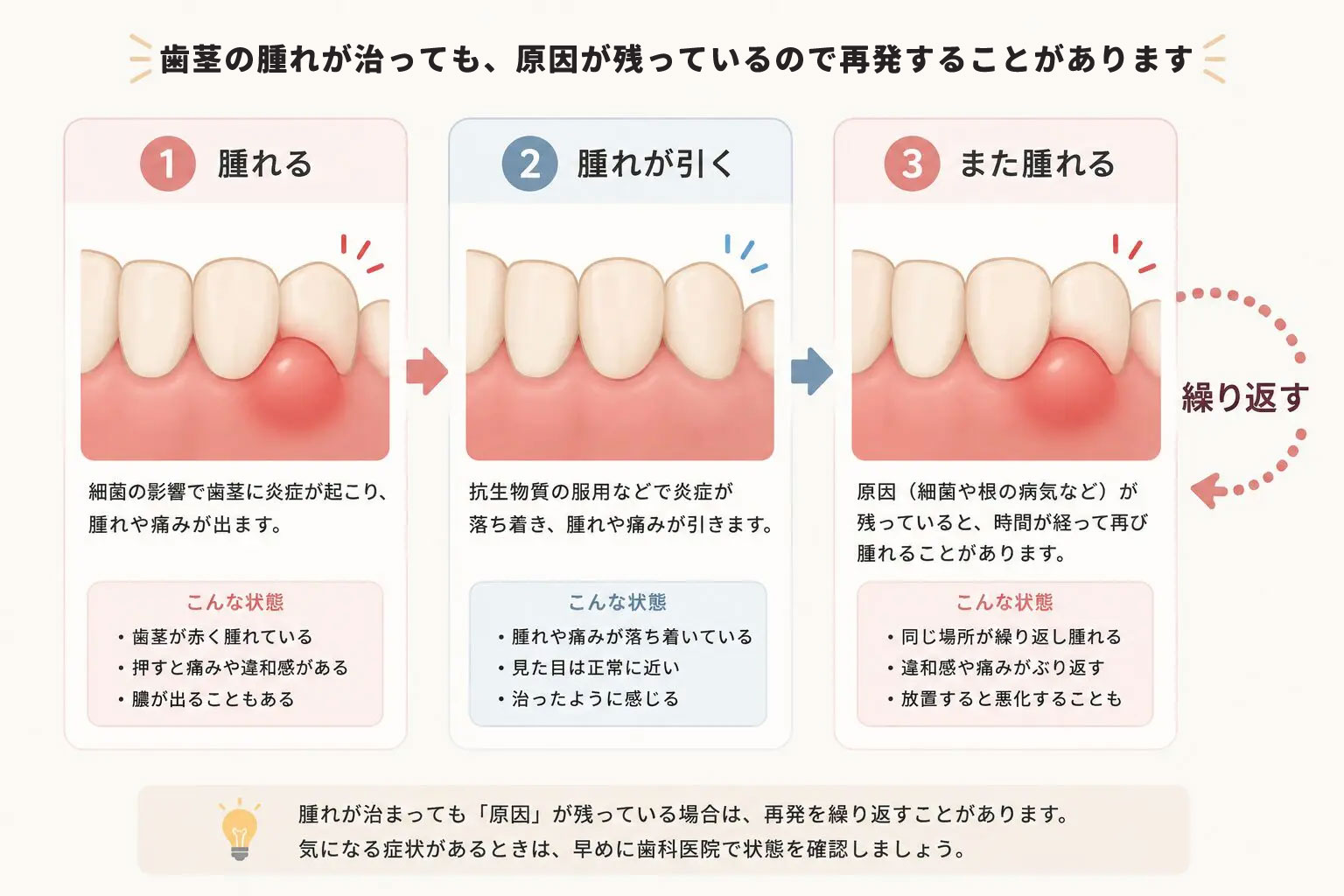歯茎が腫れて治るを繰り返す説明図