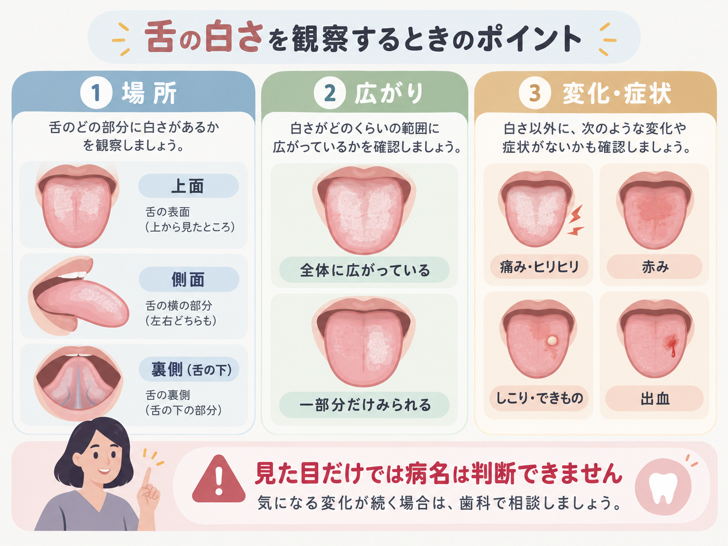 舌の白さを観察するときのポイントを示す図。場所、広がり、痛みや赤みなどの症状を確認することを説明している
